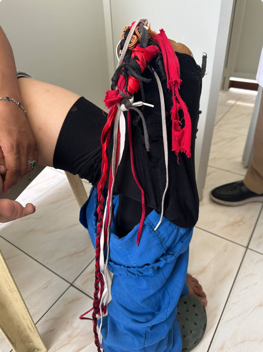 Prosthetic device with makeshift contraptions