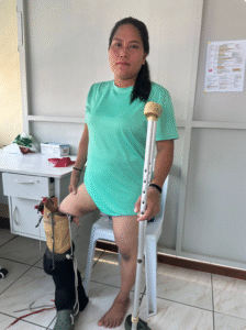 Floriza with her prosthetic device on